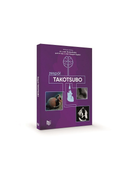 Zespół takotsubo