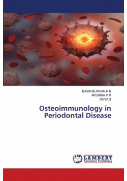 Osteoimmunology in Periodontal Disease