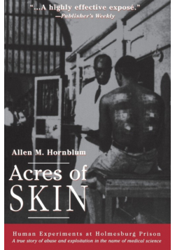 Acres of Skin
