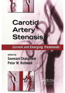 Carotid Artery Stenosis