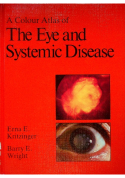 A Colour Atlas of the Eye and Systemic Diseases