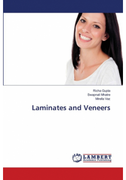 Laminates and Veneers