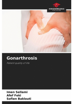Gonarthrosis