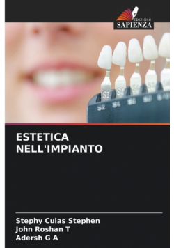 Estetica Nell'impianto