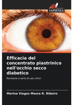Efficacia del concentrato piastrinico nell'occhio secco diabetico