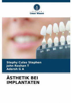 Ästhetik Bei Implantaten