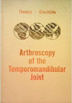 Arthroscopy of the Temporomandibular Joint