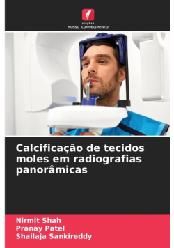 Calcificação de tecidos moles em radiografias panorâmicas