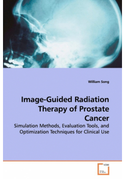 Image-Guided Radiation Therapy of Prostate Cancer