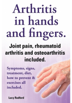 Arthritis in Hands and Arthritis in Fingers. Rheumatoid Arthritis and Osteoarthritis Included. Symptoms, Signs, Treatment, Diet, How to Prevent & Exer