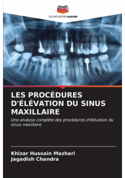 Les Procédures D'élévation Du Sinus Maxillaire
