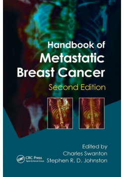 Handbook of Metastatic Breast Cancer