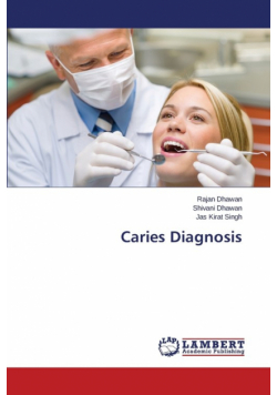 Caries Diagnosis