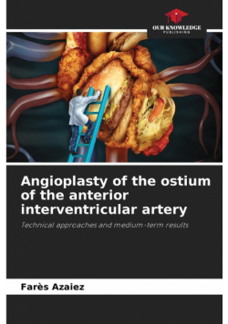 Angioplasty of the ostium of the anterior interventricular artery
