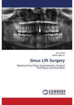 Sinus Lift Surgery