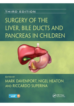 Surgery of the Liver, Bile Ducts and Pancreas in Children