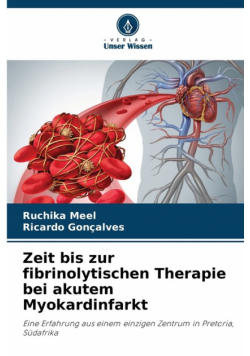 Zeit bis zur fibrinolytischen Therapie bei akutem Myokardinfarkt