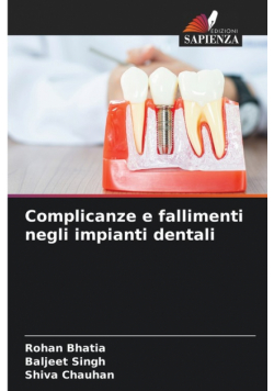 Complicanze e fallimenti negli impianti dentali
