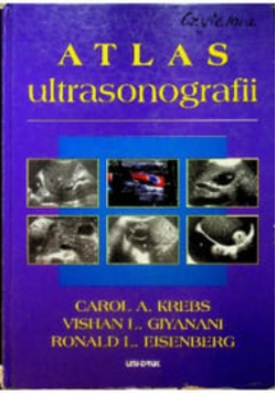 Atlas ultrasonografii układu żylnego z zastosowaniem pulsacyjnego Tom 1