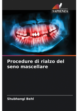 Procedure di rialzo del seno mascellare
