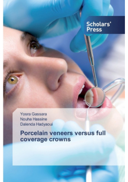 Porcelain veneers versus full coverage crowns