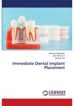 Immediate Dental Implant Placement