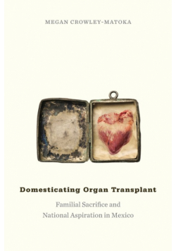 Domesticating Organ Transplant