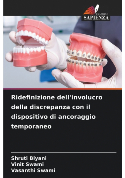 Ridefinizione dell'involucro della discrepanza con il dispositivo di ancoraggio temporaneo