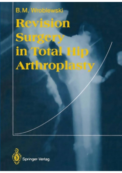 Revision Surgery in Total Hip Arthroplasty