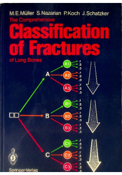 Classification of fractures