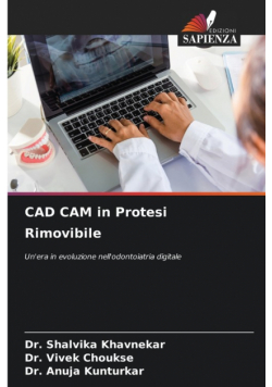 CAD CAM in Protesi Rimovibile