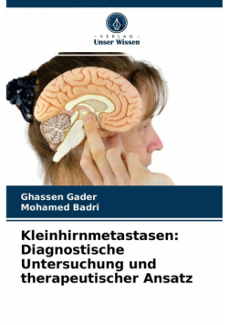 Kleinhirnmetastasen