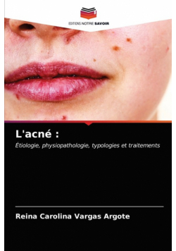 L'acné