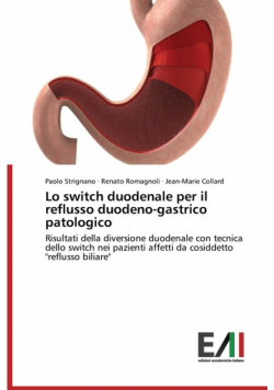 Lo switch duodenale per il reflusso duodeno-gastrico patologico
