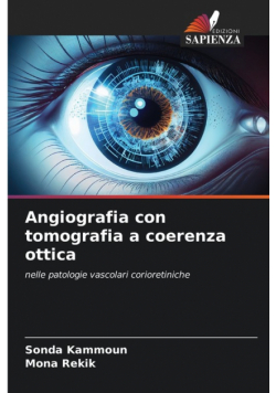 Angiografia con tomografia a coerenza ottica