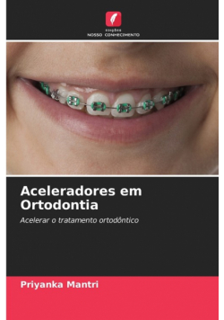 Aceleradores em Ortodontia