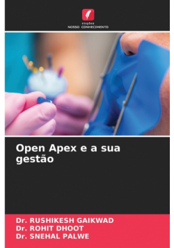Open Apex e a sua gestão