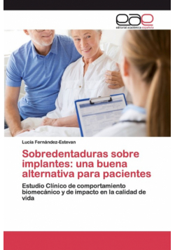 Sobredentaduras sobre implantes