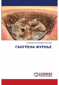 ГАНГРЕНА ФУРНЬЕ