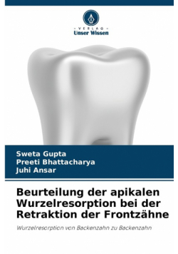 Beurteilung der apikalen Wurzelresorption bei der Retraktion der Frontzähne