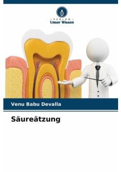 Säureätzung