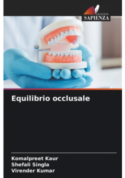 Equilibrio occlusale
