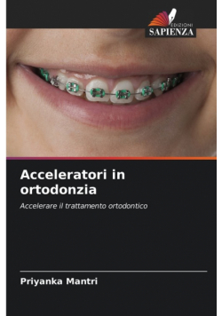 Acceleratori in ortodonzia