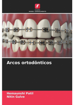 Arcos ortodônticos