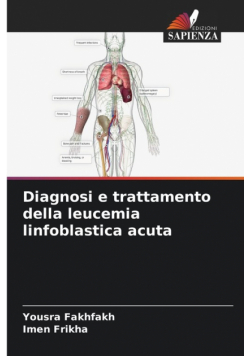 Diagnosi e trattamento della leucemia linfoblastica acuta