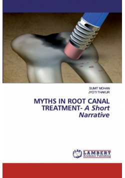 Myths in Root Canal Treatment - A Short Narrative
