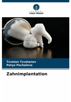 Zahnimplantation