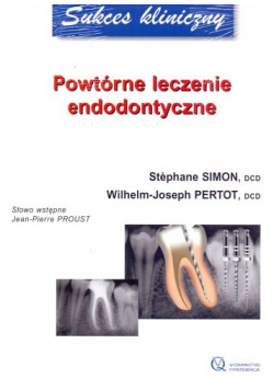 Powtórne leczenie endodontyczne