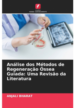 Análise dos Métodos de Regeneração Óssea Guiada