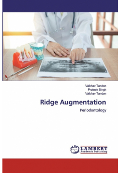 Ridge Augmentation